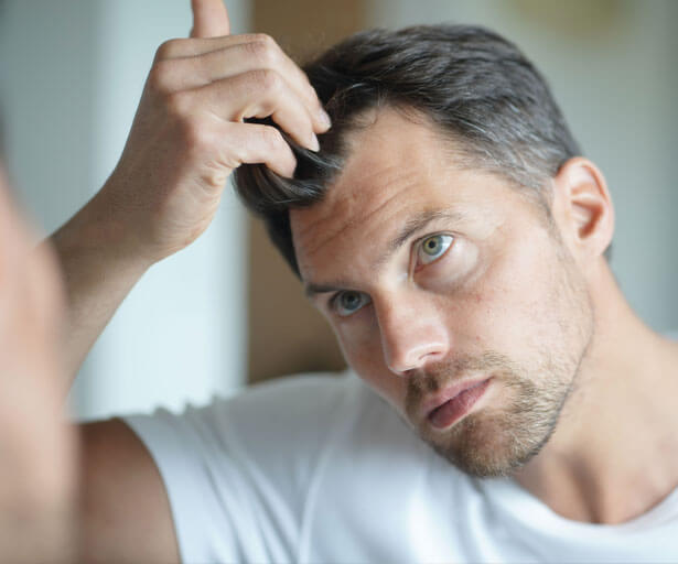 Greffe des cheveux