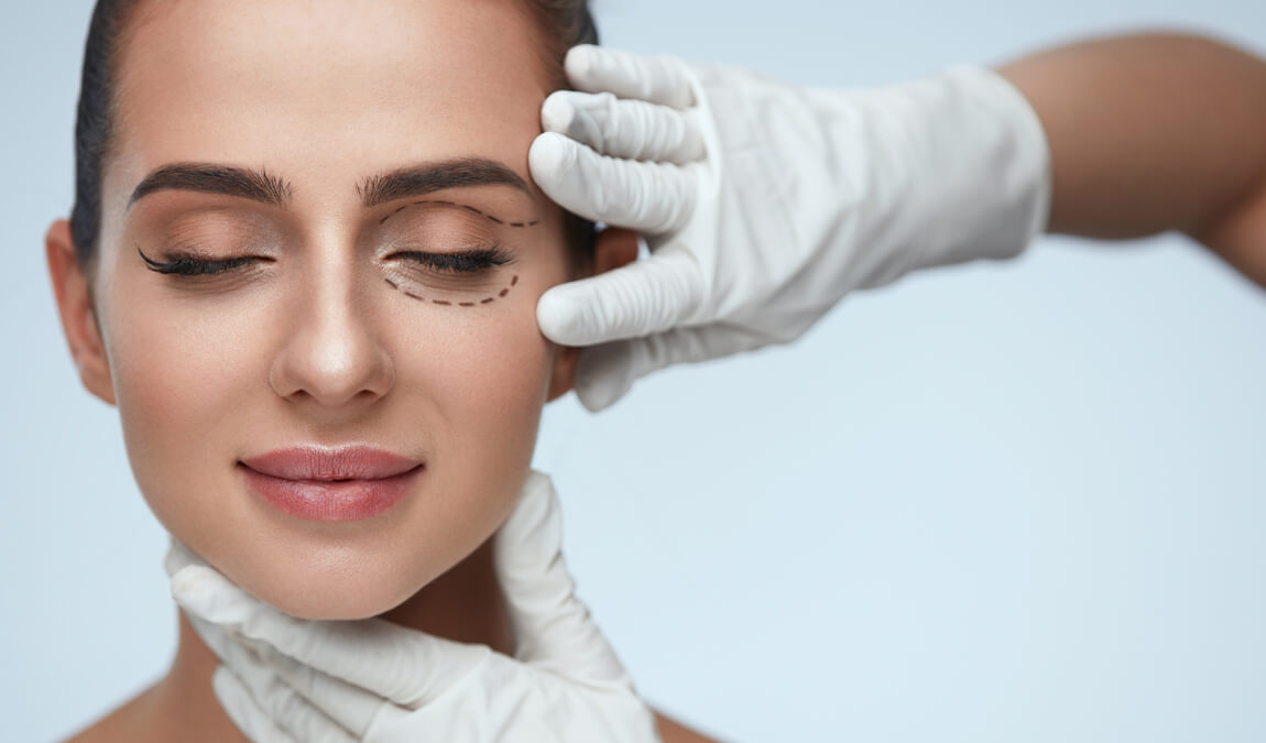 Blépharoplastie